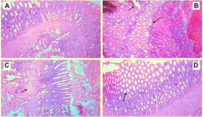 Butin Attenuates Arthritis in Complete Freund’s Adjuvant-Treated Arthritic Rats: Possibly Mediated by Its Antioxidant and Anti-Inflammatory Actions